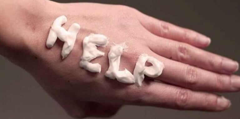 Sigurni načini za ublažavanje manjih opeklina